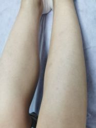 -天津伊美尔医疗整形美容专科医院