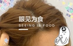 -大麦微针植发全国连锁