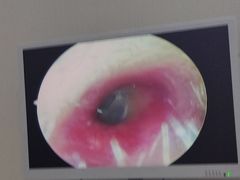 -溥耳·可视采耳·头疗·沐眼