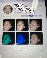 体验前-北京爱育华医院-医疗美容科