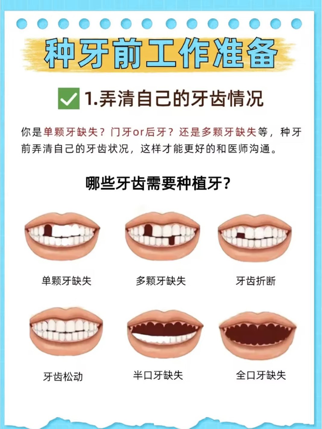 四颗门牙种植牙图片图片