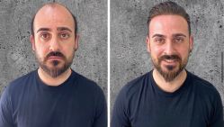 -发饰美男士增发补发假发定制店