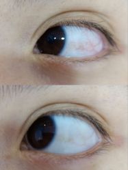 -晶奕空间专业脱毛连锁机构
