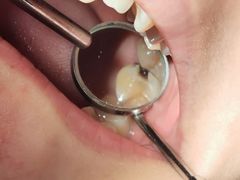 -泰康拜博口腔(世博园乐尔店)