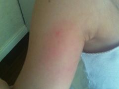 一家三口均被跳蚤咬了无数口-屋顶顶城市·江景酒店-客房部