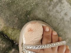 -世龙世家灰指甲鸡眼脚气甲沟炎跖疣护理(通州店)