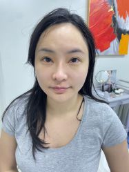 -海涛医疗美容·面部抗衰·注射美鼻