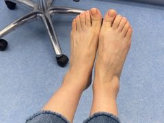 -Andrew指甲专科灰指甲·甲沟炎矫正·3D步态矫形鞋垫定制(上海法华镇路旗舰店)