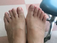 -世龙世家灰指甲鸡眼脚气甲沟炎跖疣护理(通州店)