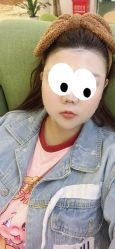 体验后-正璞医疗美容·皮肤修复·微整注射