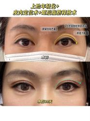 -联合丽格·张菡丽格医疗美容