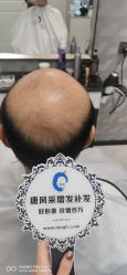 -唐风采假发补发定制