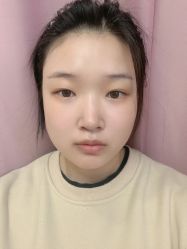 体验前-西安现代妇产医院医疗美容