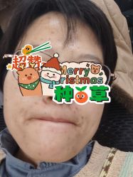 -洁铭新加坡医美