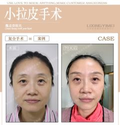 -北京丽星翼美医疗美容