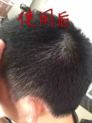 -宝诗雅莲养发养生馆