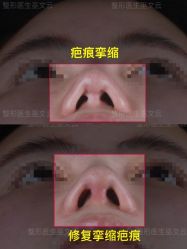 -北京米扬丽格医疗美容·联合丽格鼻整形中心