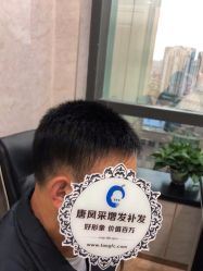 -唐风采假发补发定制