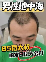 -雍禾植发全国连锁