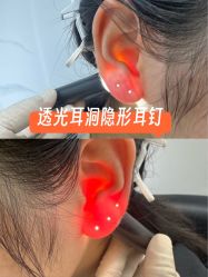 -艺耳美专业穿耳洞打耳洞穿孔