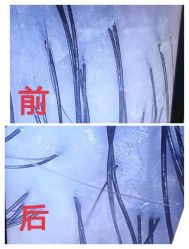 -岳灵生发养发馆