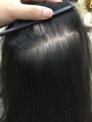 -菩叶脱发白发中心