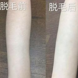 -大华韩艺整形美容医院