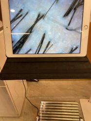 点击看大图 -希梵尔头皮抗衰·科技养发