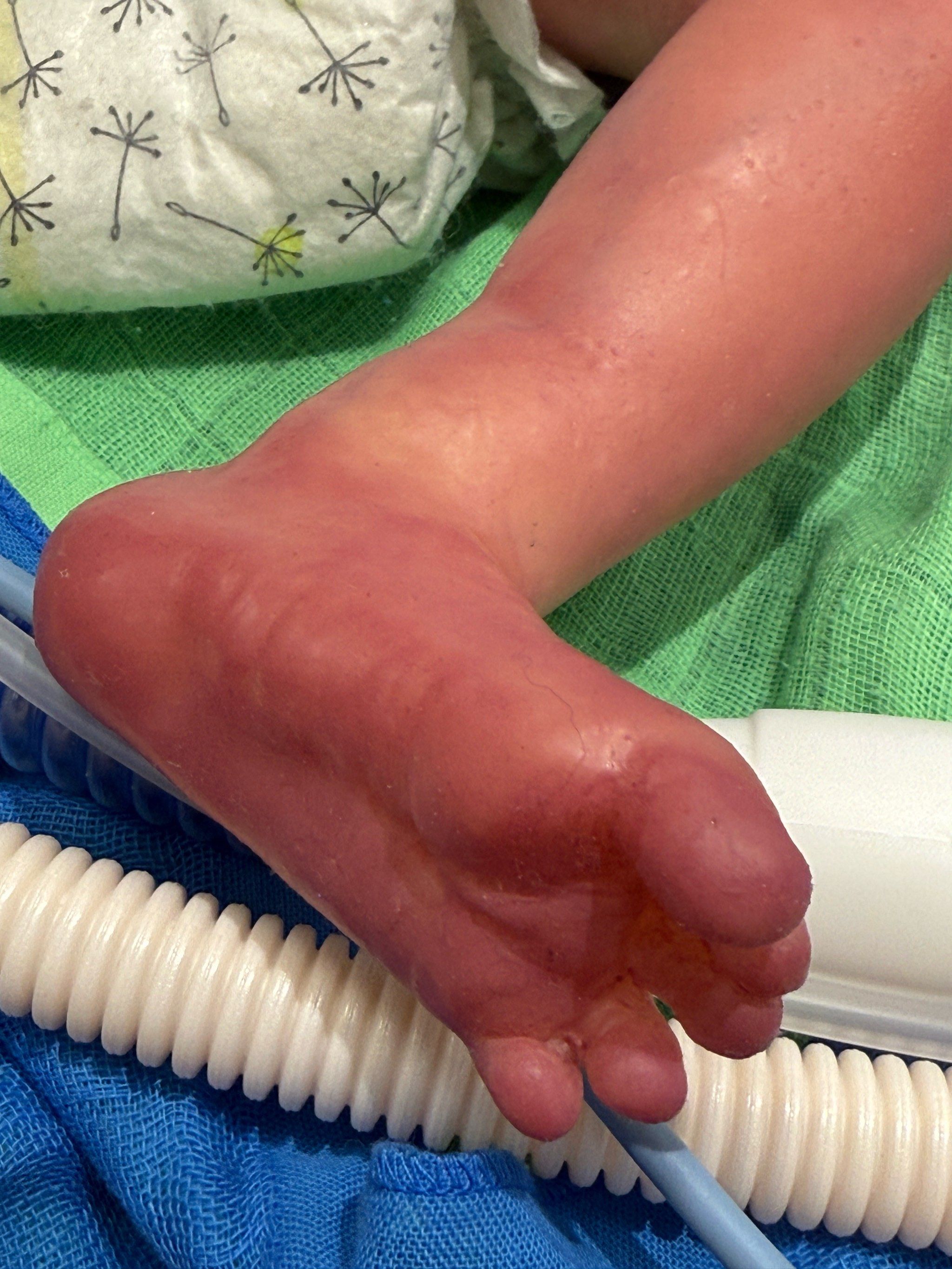 深圳有巨人的脚,我只有小宝宝的