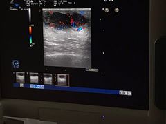 -杭州市第三人民医院