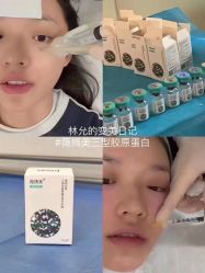 点击看大图 -AURAS璈然科技护肤中心