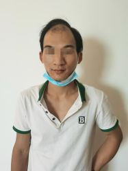 -极客侠男士假发定制补发