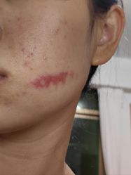 -深圳米兰柏羽医疗美容医院