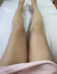 -玉笙美肤·专业脱毛中心
