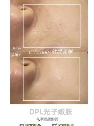 -E.beauty驻颜·痘敏肌调理中心
