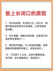 -克丽缇娜