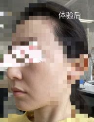 体验后-上海时光整形外科医院