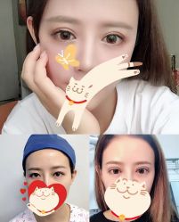 -东莞西妃整形美容医院