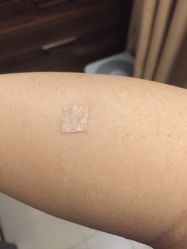 -肥三针腧穴瘦身馆