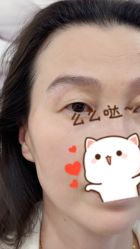 -德绣·机器野生眉发际线·美瞳线半永久
