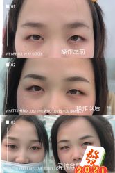 -久匠·野生眉半永久纹绣