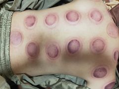 -弘善堂推拿调理