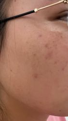 体验前-美莱医学美容医院