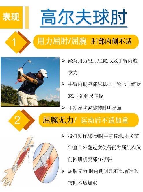 高尔夫球肘