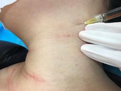 -艾通康缘艾灸.疼痛.睡眠养生馆(凤凰城店)