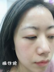 -西施无菌半永久纹绣眉眼影唇轻增发纹发际线