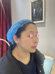 体验前-武汉颜范薇美医疗美容门诊部
