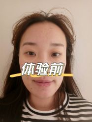 体验前-北京博泽医疗美容门诊部