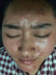 点击看大图 -莱尚·皮肤管理·痘肌护理