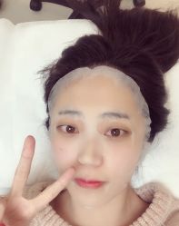 体验后-联合丽格·张菡丽格医疗美容